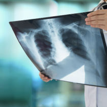 new jersey mesothelioma claims